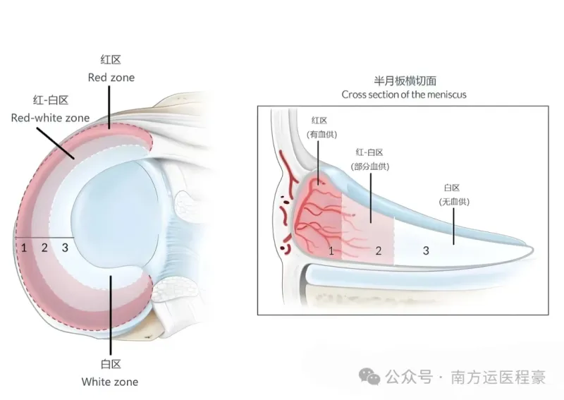 半月板缝合医生想告诉你的大实话(图2)