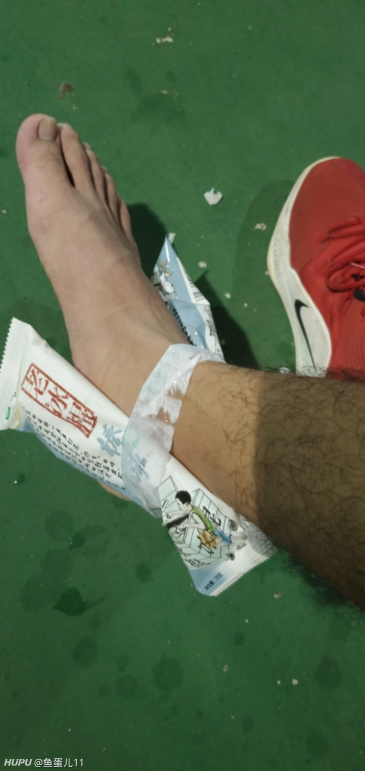 女朋友脚扭了