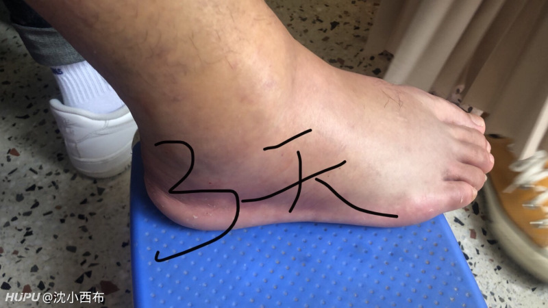 崴脚注意安全 虎扑