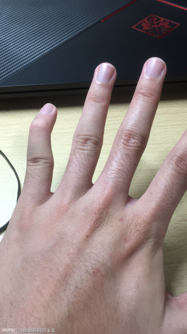 打球的时候小拇指