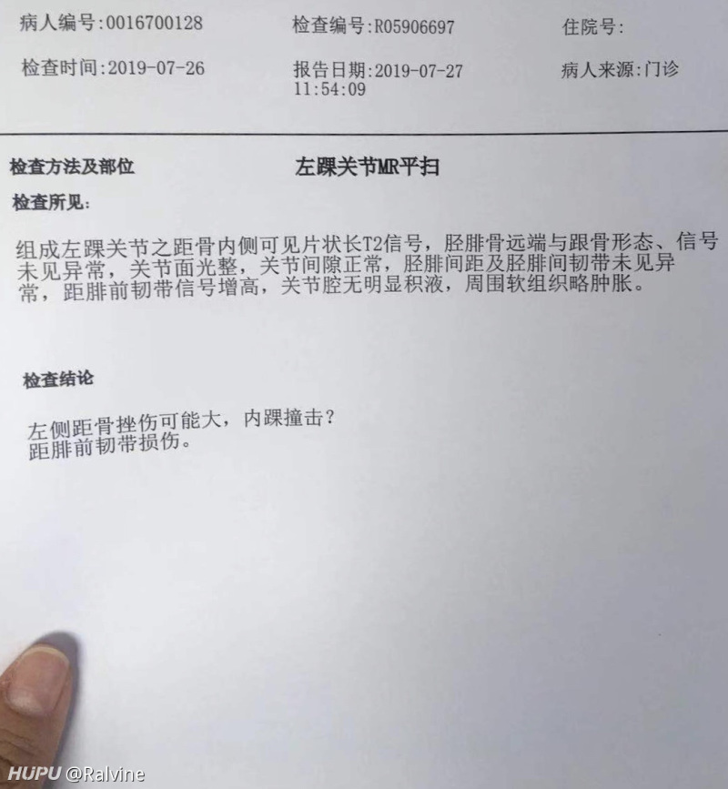 有没有距腓前韧带损伤的老哥