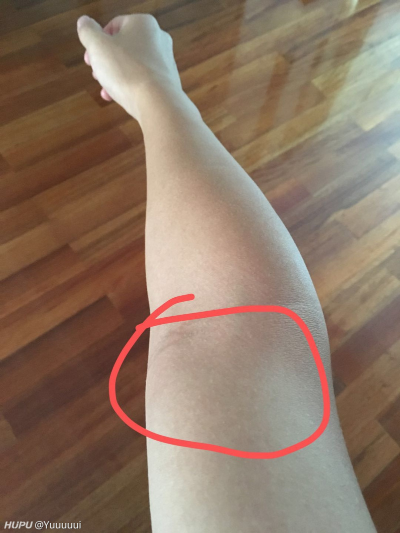 打完球右手手臂肌肉一直疼是怎么回事