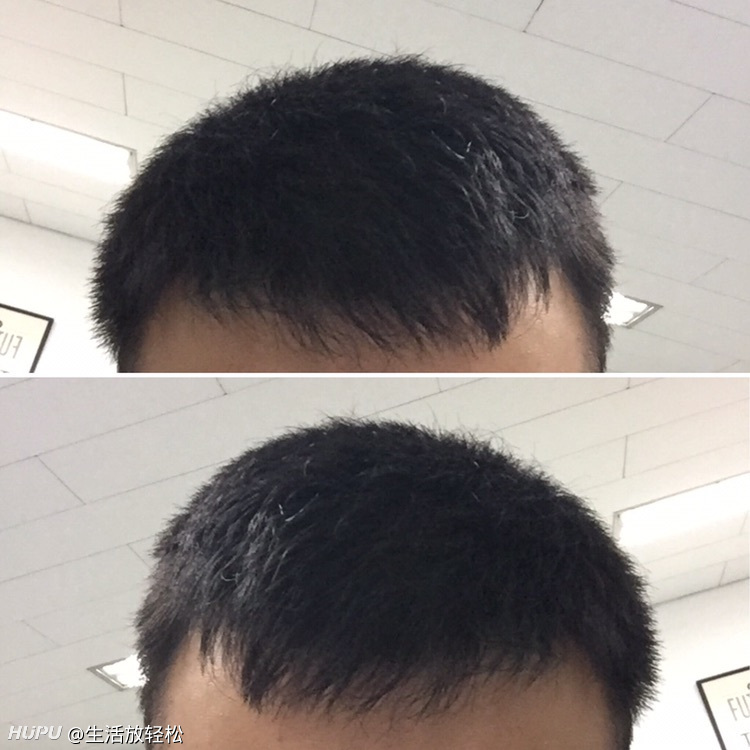我这发际线什么水平