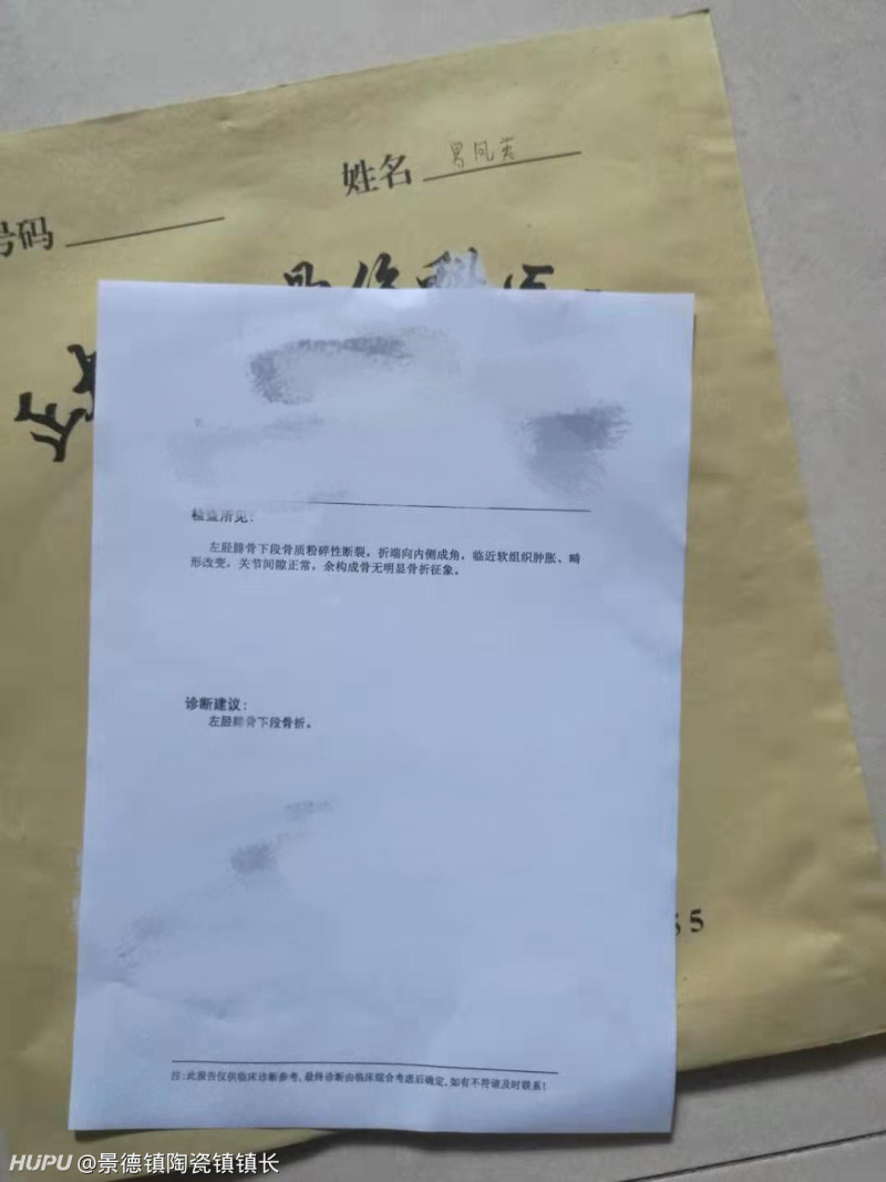 外婆帮人搬东西滑倒胫腓骨粉碎性骨折 对方有责任吗 虎扑