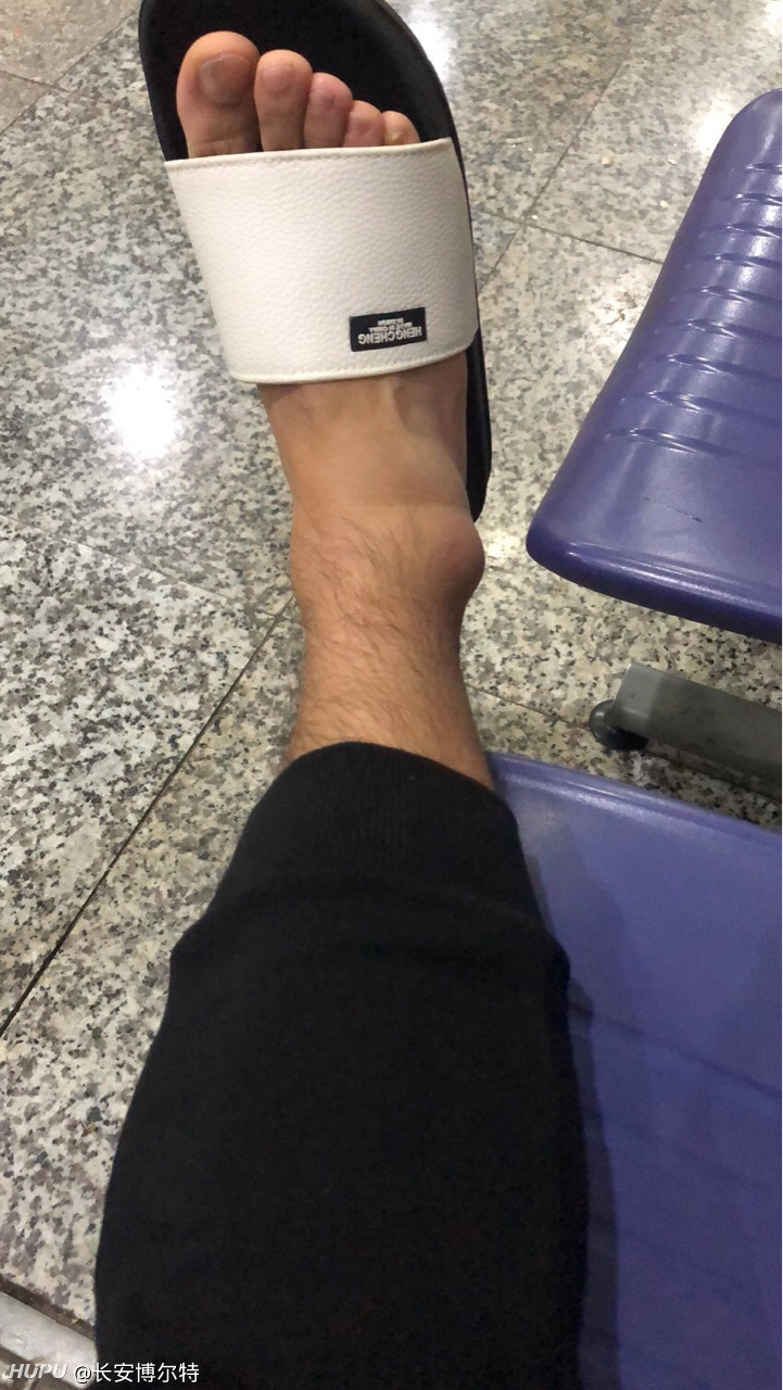 关于脚踝扭伤的问题 虎扑