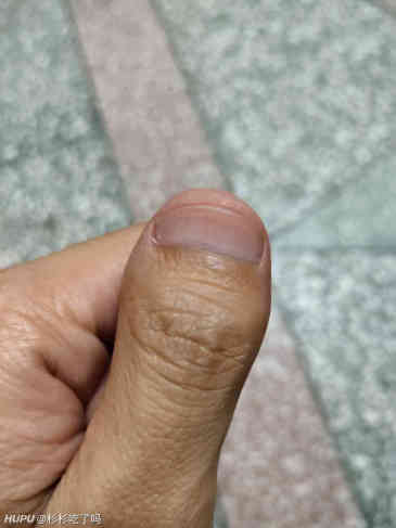 我这个大拇指什么水平?街上有一样的么?